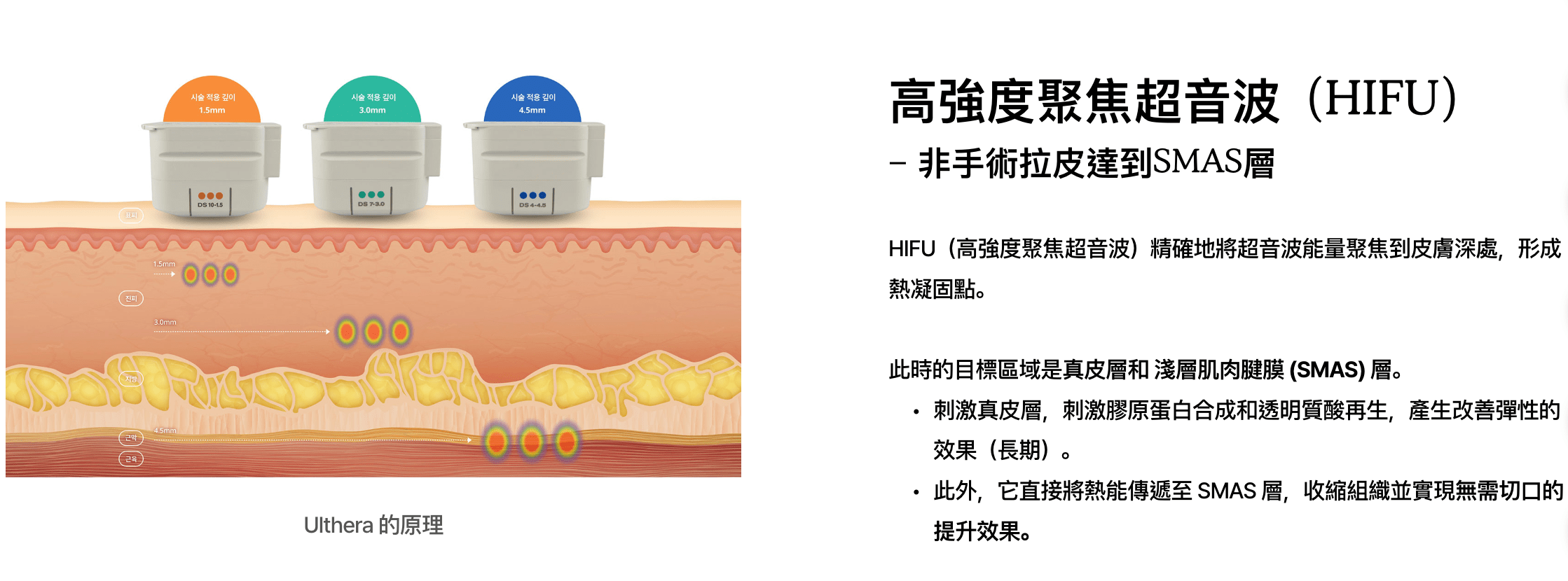 韓國醫美】超聲刀HIFU 同熱瑪吉有咩分別？緊緻拉提全攻略！附韓國超聲刀熱瑪吉推薦