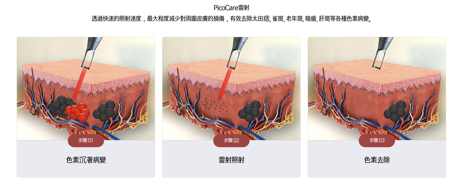 2025韓國皮秒雷射】去斑、痘印、暗沉全攻略！費用、修復期、用家經驗深度解析